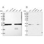 Western blot analysis using Anti-PSMA1 antibody HPA037646 (A) shows similar pattern to independent antibody HPA043891 (B).
