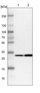 Lane 1: NIH-3T3 cell lysate (Mouse embryonic fibroblast cells)_br/_Lane 2: NBT-II cell lysate (Rat Wistar bladder tumour cells)