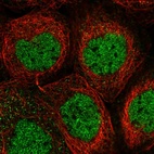 Immunofluorescent staining of human cell line A-431 shows localization to nucleoplasm.