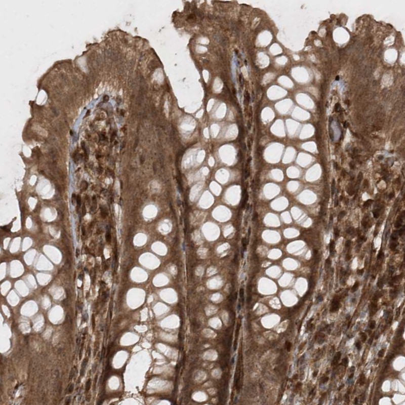 Anti-AVPI1 Antibody
