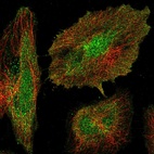 Immunofluorescent staining of human cell line HeLa shows localization to nucleus & plasma membrane.