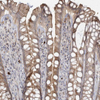 Immunohistochemical staining of human rectum shows moderate cytoplasmic positivity in glandular cells.