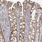 Immunohistochemical staining of human rectum shows moderate cytoplasmic positivity in glandular cells.