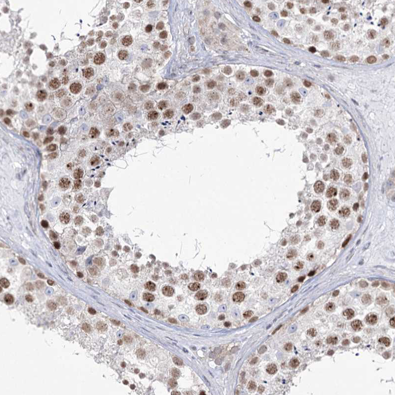 Anti-FAM175A Antibody