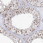 Anti-FAM175A Antibody