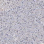 Immunohistochemical staining of human pancreas shows no positivity in exocrine glandular cells as expected.
