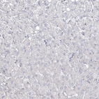 Anti-FAM175A Antibody