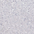 Immunohistochemical staining of human liver shows no positivity in hepatocytes as expected.