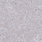Immunohistochemical staining of human pancreas shows no positivity in exocrine glandular cells as expected.