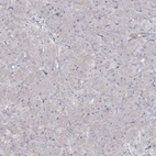 Immunohistochemical staining of human pancreas shows no positivity in exocrine glandular cells as expected.