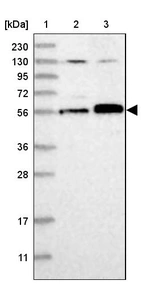 Lane 1: Marker [kDa] 230, 130, 95, 72, 56, 36, 28, 17, 11_br/_Lane 2: Human cell line RT-4_br/_Lane 3: Human cell line U-251 MG