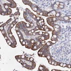 Anti-C6orf1 Antibody