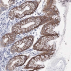 Immunohistochemical staining of human stomach shows moderate membranous positivity in glandular cells.