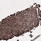 Immunohistochemical staining of human urinary bladder shows strong membranous positivity in urothelial cells.