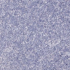 Immunohistochemical staining of human tonsil shows no positivity in non-germinal center cells as expected.