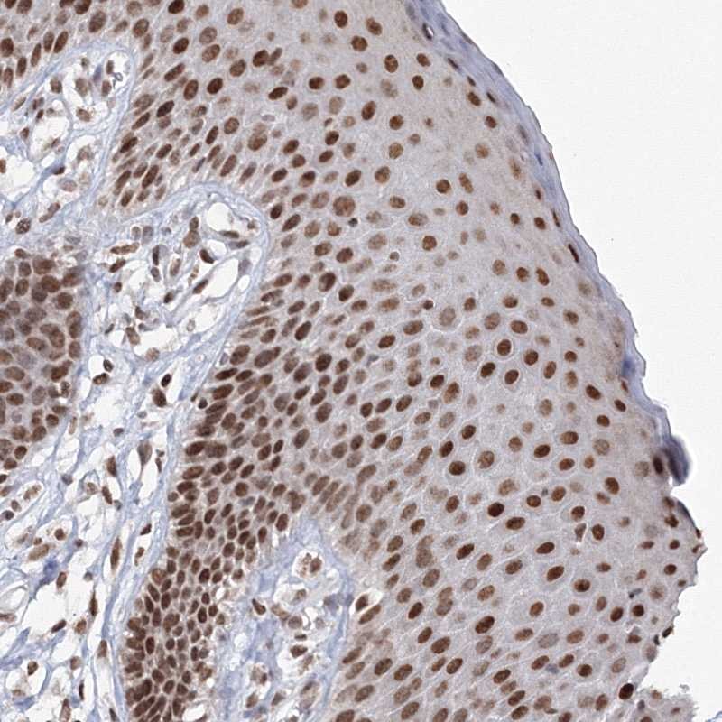 Anti-C3orf33 Antibody