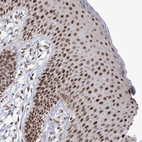 Anti-C3orf33 Antibody