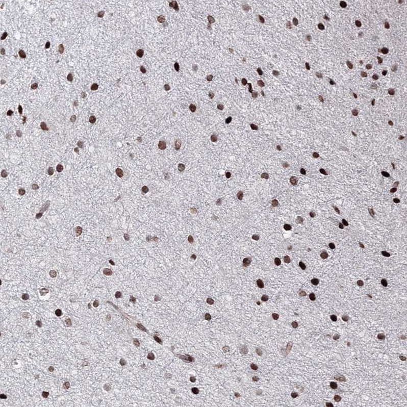 Anti-C6orf1 Antibody