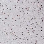 Anti-C6orf1 Antibody