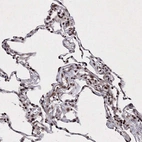 Immunohistochemical staining of human lung shows strong nuclear positivity in pneumocytes.