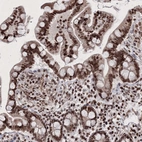 Immunohistochemical staining of human colon shows strong nuclear positivity in glandular cells.