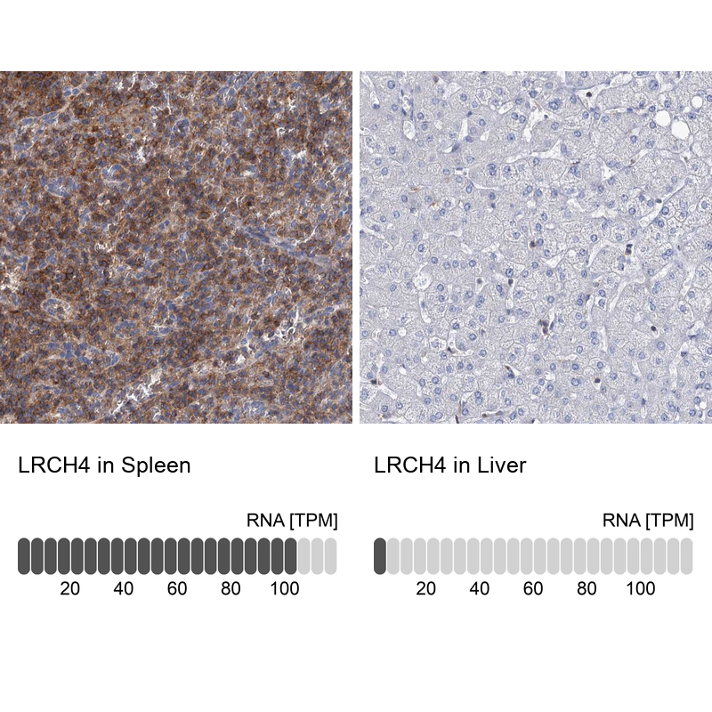 Anti-LRCH4 Antibody
