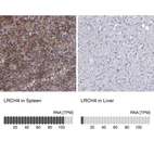 Anti-LRCH4 Antibody