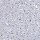 Immunohistochemical staining of human liver shows low expression as expected.
