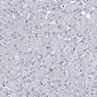 Immunohistochemical staining of human liver shows low expression as expected.