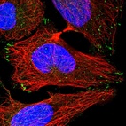 Immunofluorescent staining of human cell line U-2 OS shows localization to focal adhesion sites.