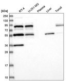 Anti-SREK1 Antibody