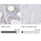 Anti-SREK1 Antibody