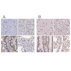 Immunohistochemical staining of human cerebral cortex, liver, small intestine and testis using Anti-SREK1 antibody HPA037674 (A) shows similar protein distribution across tissues to independent antibody HPA059332 (B).