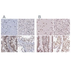 Immunohistochemical staining of human cerebral cortex, liver, small intestine and testis using Anti-SREK1 antibody HPA037674 (A) shows similar protein distribution across tissues to independent antibody HPA059332 (B).