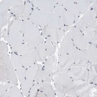 Immunohistochemical staining of human skeletal muscle shows low expression as expected.