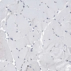 Immunohistochemical staining of human skeletal muscle shows low expression as expected.