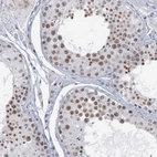 Immunohistochemical staining of human testis shows high expression.