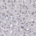 Immunohistochemical staining of human liver using Anti-SREK1 antibody HPA037674.