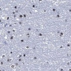 Immunohistochemical staining of human cerebral cortex using Anti-SREK1 antibody HPA037674.