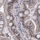 Immunohistochemical staining of human small intestine using Anti-SREK1 antibody HPA037674.