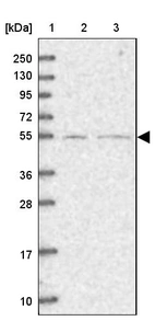 Lane 1: Marker [kDa] 250, 130, 95, 72, 55, 36, 28, 17, 10_br/_Lane 2: Human cell line RT-4_br/_Lane 3: Human cell line U-251MG sp