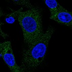Immunofluorescent staining of human cell line Hep G2 shows localization to cytosol.