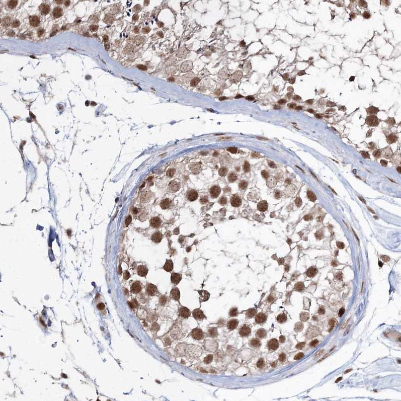 Anti-QRICH1 Antibody