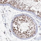 Anti-QRICH1 Antibody