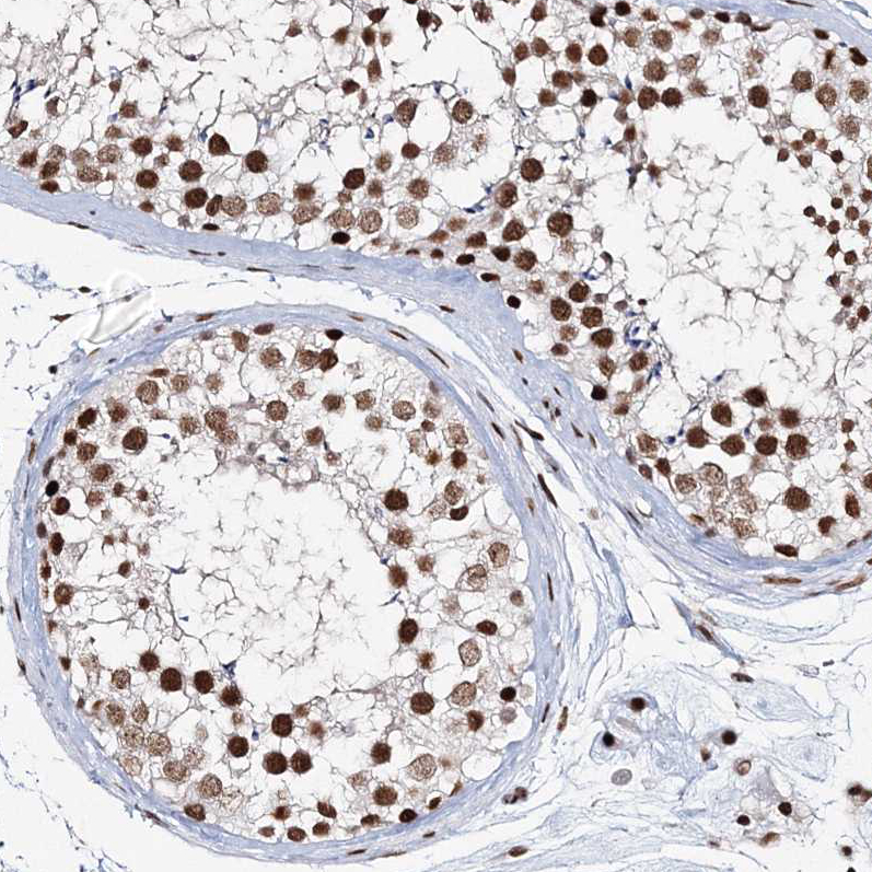 Anti-QRICH1 Antibody