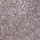 Immunohistochemical staining of human tonsil shows strong nuclear positivity in non-germinal center cells.