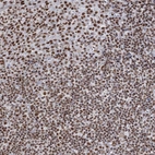 Immunohistochemical staining of human tonsil shows strong nuclear positivity in non-germinal center cells.