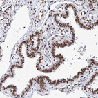 Immunohistochemical staining of human Fallopian tube shows strong nuclear positivity in glandular cells.
