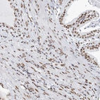Immunohistochemical staining of human prostate shows moderate nuclear positivity in smooth muscle cells and glandular cells.