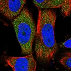Immunofluorescent staining of human cell line U-251 MG shows localization to cytosol.